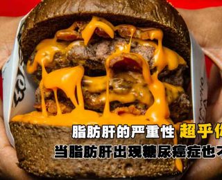 8214-上班这些坏习惯养出脂肪肝：天啊！今天开始都不敢这样做了fi2